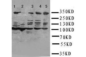 Anti-ATM antibody, Western blotting Lane 1: HELA Cell Lysate Lane 2: SMMC Cell Lysate Lane 3: U87 Cell Lysate Lane 4: A549 Cell Lysate Lane 5: MCF-7 Cell Lysate