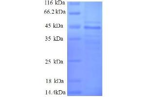 Myosin Light Chain 6, Alkali, Smooth Muscle and Non Muscle (MYL6) (AA 3-151), (partial) protein (GST tag) (MYL6 Protein (AA 3-151, partial) (GST tag))