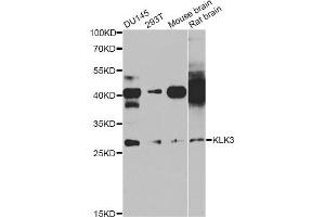 Western blot analysis of extracts of various cell lines, using KLK3 antibody (ABIN5971083) at 1/1000 dilution. (Prostate Specific Antigen antibody)