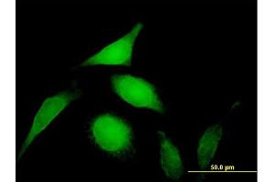 Immunofluorescence of purified MaxPab antibody to PSMD14 on HeLa cell. (PSMD14 antibody  (AA 1-310))