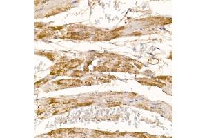 Immunohistochemistry of paraffin-embedded mouse heart using COX7 Rabbit pAb (4721) at dilution of 1:100 (40x lens). (COX7A1 antibody  (AA 1-79))