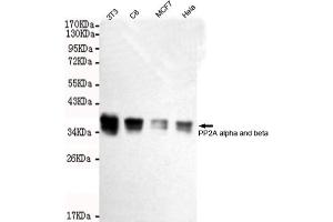 Western blot detection of A alpha and beta in Hela,MCF7,C6 and 3T3 cell lysates using A alpha and beta mouse mAb (1:2000 diluted). (PP2A alpha/beta antibody)