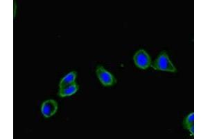 Immunofluorescent analysis of HepG2 cells using ABIN7152681 at dilution of 1:100 and Alexa Fluor 488-congugated AffiniPure Goat Anti-Rabbit IgG(H+L) (FRMD5 antibody  (AA 295-504))