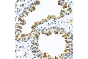 Immunohistochemistry of paraffin-embedded mouse lung using SERPINA10 antibody. (SERPINA10 antibody  (AA 165-444))