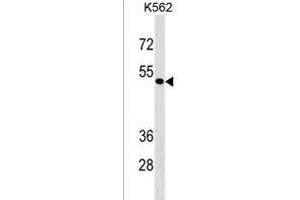 ZN Antibody (Center) (ABIN1537894 and ABIN2843344) western blot analysis in K562 cell line lysates (35 μg/lane). (ZNF733 antibody  (AA 156-183))