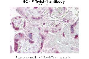 Image no. 2 for anti-Twist Homolog 1 (Drosophila) (TWIST1) (N-Term) antibody (ABIN347415) (TWIST1 antibody  (N-Term))