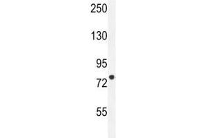 CPT1C antibody western blot analysis in HL-60 lysate. (CPT1C antibody  (AA 752-782))