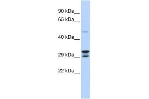 WB Suggested Anti-C14orf166 Antibody Titration:  0. (C14orf166 antibody  (N-Term))