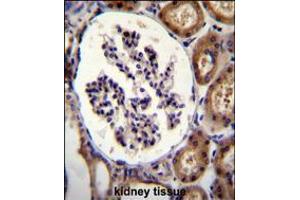 ITGA8 Antibody immunohistochemistry analysis in formalin fixed and paraffin embedded human kidney tissue followed by peroxidase conjugation of the secondary antibody and DAB staining. (ITGA8 antibody  (C-Term))