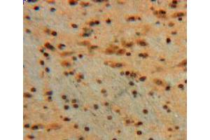 Used in DAB staining on fromalin fixed paraffin-embedded brain tissue (Galectin 3 antibody  (AA 1-262))