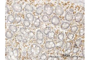 Immunoperoxidase of purified MaxPab antibody to SEPT12 on formalin-fixed paraffin-embedded human colon. (Septin 12 antibody  (AA 1-358))