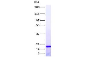 Western Blotting (WB) image for Tumor Necrosis Factor Receptor Superfamily, Member 1A (TNFRSF1A) protein (ABIN2713389)