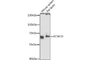 Western blot analysis of extracts of various cell lines using KCNK10 Polyclonal Antibody at dilution of 1:3000. (KCNK10 antibody)