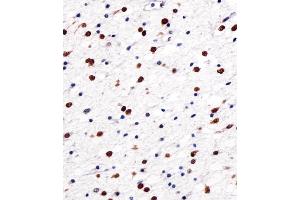 Immunohistochemical analysis of paraffin-embedded H. (NOVA1 antibody  (AA 139-173))