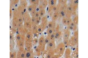 Used in DAB staining on fromalin fixed paraffin-embedded liver tissue (ROCK1 antibody  (AA 1094-1323))