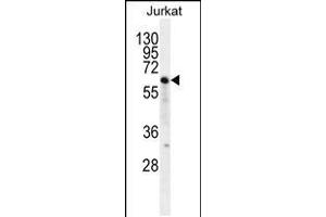 Western blot analysis in Jurkat cell line lysates (35ug/lane). (NKD2 antibody  (C-Term))