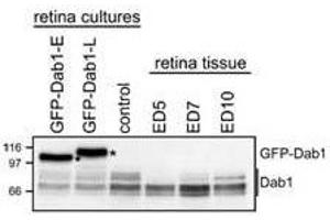 WB - Dab1 Antibody Analysis of GFP-Dab1 and endogenous Dab1 levels in transfected retinal cells and retinal tissue.