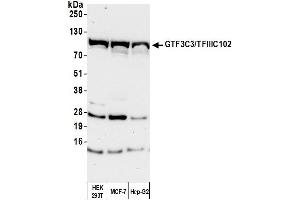 Western Blotting (WB) image for anti-General Transcription Factor 3C Polypeptide 3 (GTF3C3) (AA 475-525) antibody (ABIN7454731) (General Transcription Factor 3C Polypeptide 3 (GTF3C3) (AA 475-525) antibody)