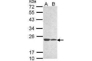 WB Image Sample (30 ug of whole cell lysate) A: 293T B: A431 , 12% SDS PAGE antibody diluted at 1:1000 (C11orf85 antibody  (Center))