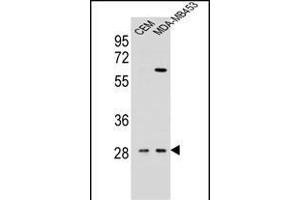 IL12B Antibody (C-term) (ABIN654420 and ABIN2844155) western blot analysis in CEM,MDA-M cell line lysates (35 μg/lane). (IL12B antibody  (C-Term))