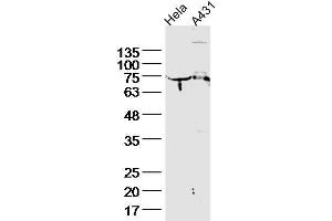 Lane 1, HeLa lysates, Lane 2, A431 lysate probed with Cytokeratin 2e Polyclonal Antibody, unconjugated  at 1:300 overnight at 4°C followed by a conjugated secondary antibody for 60 minutes at 37°C. (Keratin 2 antibody  (AA 251-350))