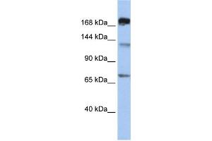 WB Suggested Anti-MTR Antibody Titration:  0. (MTR antibody  (C-Term))