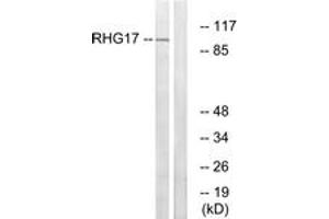 Western Blotting (WB) image for anti-rho GTPase Activating Protein 17 (ARHGAP17) (AA 331-380) antibody (ABIN2890584) (ARHGAP17 antibody  (AA 331-380))