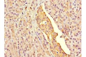 Immunohistochemistry of paraffin-embedded human pancreatic tissue using ABIN7153908 at dilution of 1:100 (G6PC2 antibody  (AA 78-115))