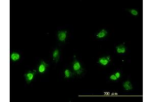 Immunofluorescence (IF) image for anti-NIMA (Never In Mitosis Gene A)-Related Kinase 11 (NEK11) (AA 1-482) antibody (ABIN566395)