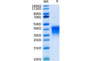 Human CD7 on Tris-Bis PAGE under reduced condition. (CD7 Protein (CD7) (His-Avi Tag))