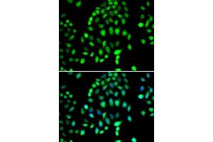 Immunofluorescence analysis of MCF-7 cells using P antibody (ABIN6132460, ABIN6145238, ABIN6145239 and ABIN6223130). (PARP3 antibody  (AA 301-540))