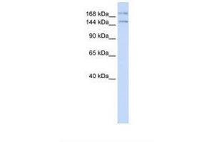 Image no. 1 for anti-Intraflagellar Transport 140 Homolog (IFT140) (AA 108-157) antibody (ABIN6737803) (IFT140 antibody  (AA 108-157))