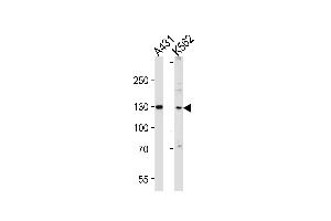 Western blot analysis of lysates from A431, K562 cell line (from left to right), using GALNT5 Antibody at 1:1000 at each lane. (GALNT5 antibody  (N-Term))