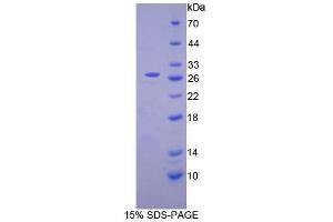 SDS-PAGE analysis of Mouse Complement Receptor 2 Protein. (CD21 Protein)