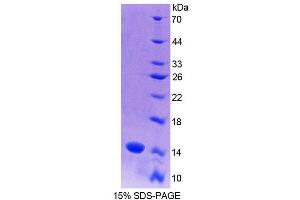 SDS-PAGE (SDS) image for S100 Calcium Binding Protein A9 (S100A9) (AA 1-113) protein (His tag) (ABIN1080760)