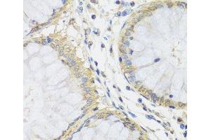 Immunohistochemistry of paraffin-embedded Human colon using MTX1 Polyclonal Antibody at dilution of 1:100 (40x lens).