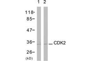 Western blot analysis of extracts from A2780 cells, using CDK2 (Ab-160) Antibody. (CDK2 antibody  (AA 131-180))