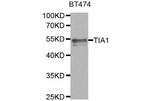 Western Blotting (WB) image for anti-TIA1 Cytotoxic Granule-Associated RNA Binding Protein (TIA1) antibody (ABIN1882364) (TIA1 antibody)
