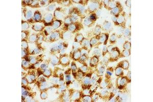 Anti-Collagen I antibody,  ICC ICC: NIH3T3 Cell