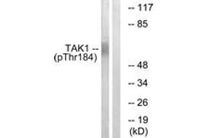 Western blot analysis of extracts from HepG2 cells treated with TNF 20ng/ml 5', using TAK1 (Phospho-Thr184) Antibody. (TR4 antibody  (pThr184))
