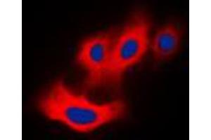 Immunofluorescent analysis of PAK4 (pS474) staining in Raw264. (PAK4 antibody  (C-Term, pSer474))