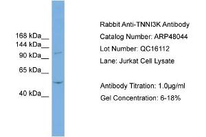 WB Suggested Anti-TNNI3K  Antibody Titration: 0. (TNNI3K antibody  (N-Term))