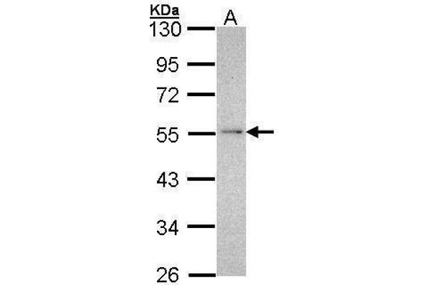 NDUFV1 antibody  (Center)