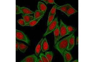 Immunofluorescence Analysis of Human HeLa cells labeling SPTBN2 with Spectrin beta III Rabbit Recombinant Monoclonal (SPTBN2/2887R) followed by Goat anti-mouse IgG-CF488 (Green). (Recombinant Spectrin, Beta, Non-erythrocytic 2 (SPTBN2) (AA 356-475) antibody)