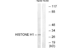 Immunohistochemistry analysis of paraffin-embedded human colon carcinoma tissue using Histone H1 (Ab-17) antibody. (Histone H1 antibody)