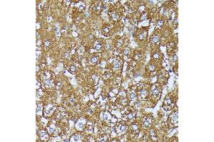 Immunohistochemistry of paraffin-embedded rat liver using C2 Rabbit pAb (ABIN7265549) at dilution of 1:100 (40x lens).