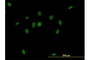 Immunofluorescence of monoclonal antibody to CSE1L on HeLa cell. (Exportin 2 antibody  (AA 872-971))