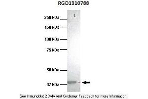 Lanes:  Lane1: 25ug human bronchoepithelisal lysate Primary Antibody Dilution:  1:1000 Secondary Antibody:  Goat anti-rabbit HRP Secondary Antibody Dilution:  1:1000 Gene Name:  RGD1310788 Submitted by:  Murline Gelin, University of Miami School of Medicine (HVCN1 antibody  (C-Term))