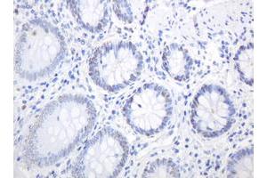 Image no. 6 for anti-Proliferating Cell Nuclear Antigen (PCNA) antibody (ABIN1500061) (PCNA antibody)