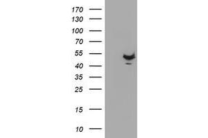 HEK293T cells were transfected with the pCMV6-ENTRY control (Left lane) or pCMV6-ENTRY KCNAB1 (Right lane) cDNA for 48 hrs and lysed. (KCNAB1 antibody)